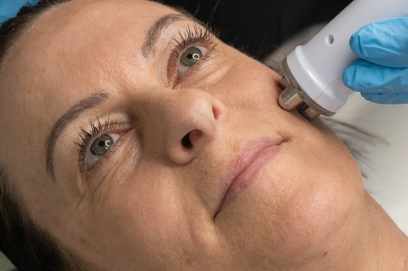 Facial treatment