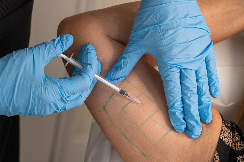 Fat dissolving treatment