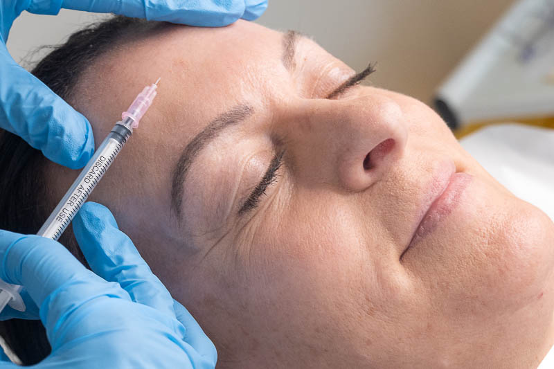 Skin booster treatment