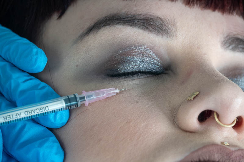 Under eye skin booster treatment